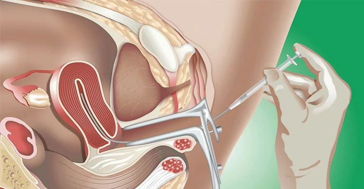 IVF Treatment best ivf centre in lucknow IVF in lucknow ivf hospital in lucknow ivf center in lucknow