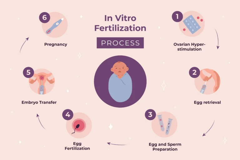 steps of ivf process